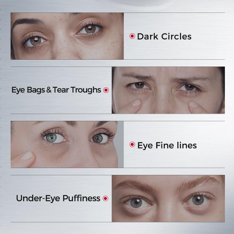 다크서클용 아이패치 – 콜라겐, 아세틸 헥사펩타이드-8 - Eye Pad Collagen 리뷰 및 가격